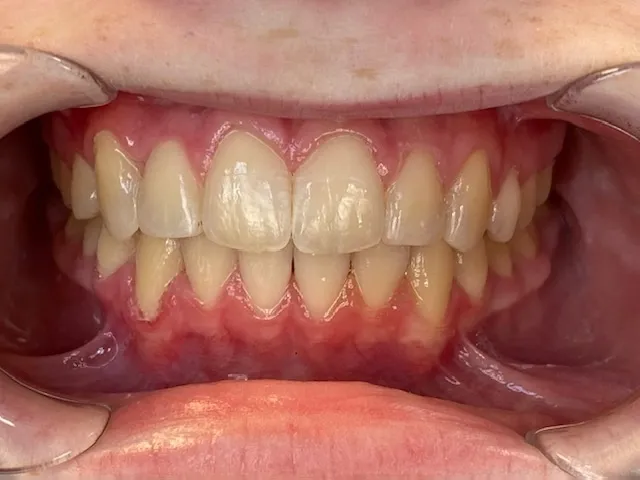 Case 10 after treatment