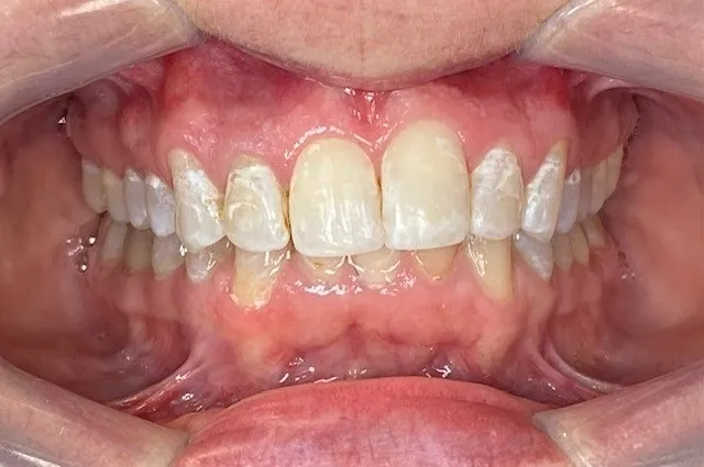 Case 2 after