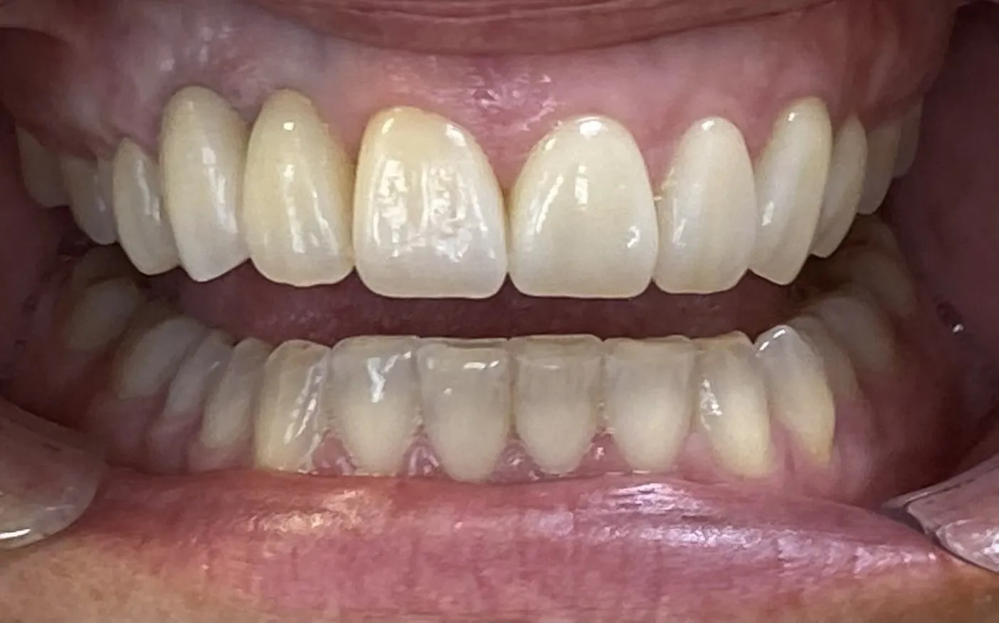Case 9 after