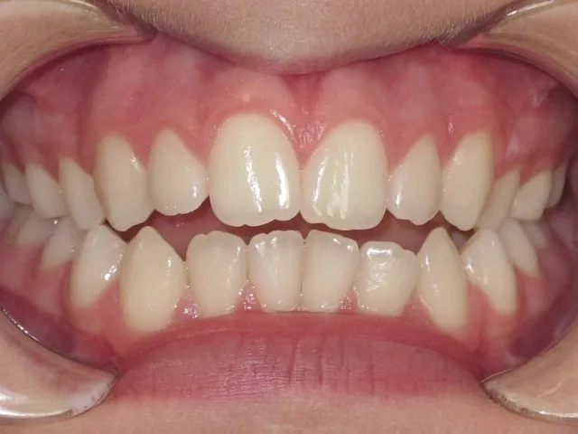 Case 1 before treatment