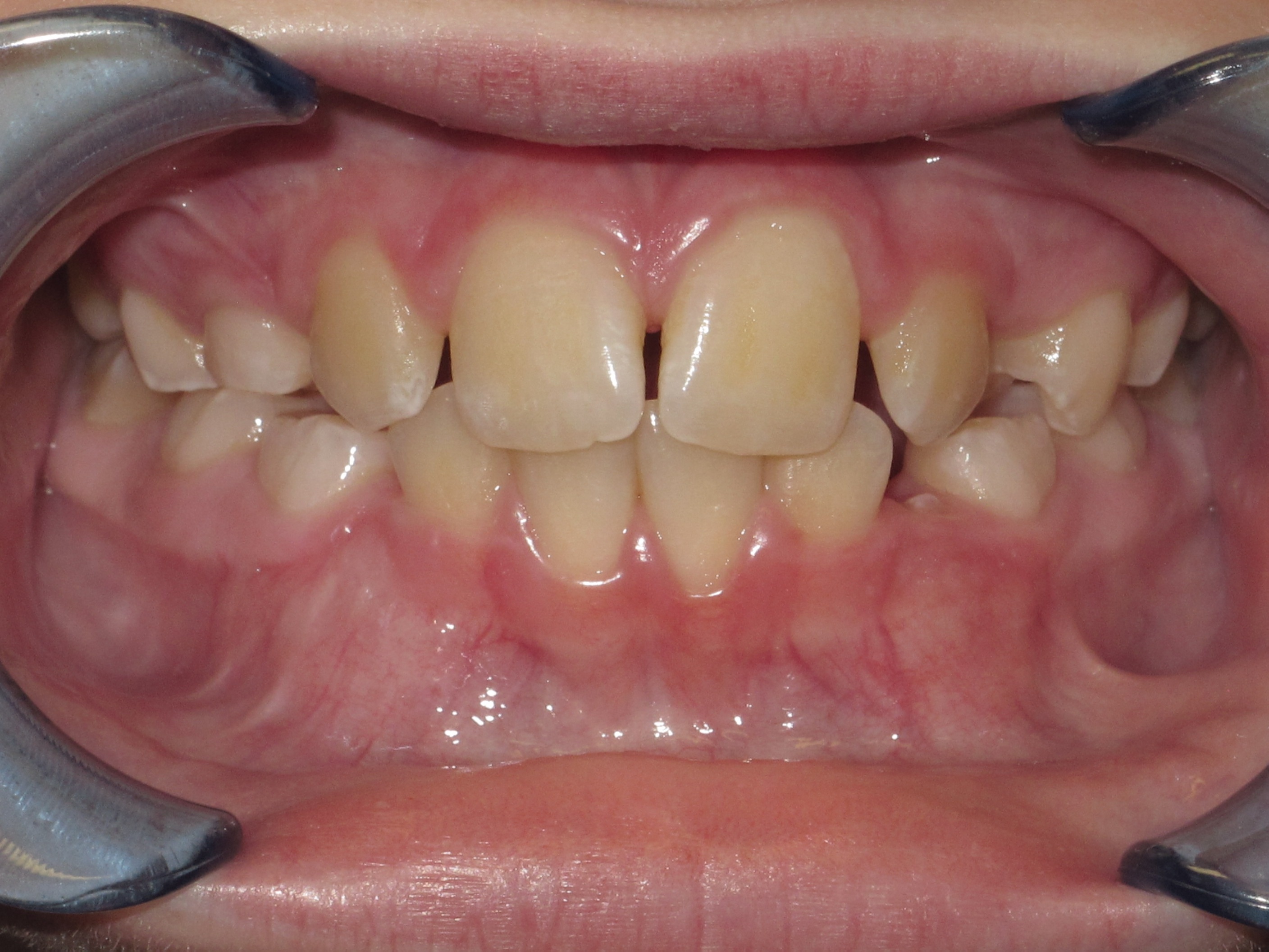 Case 10 before treatment