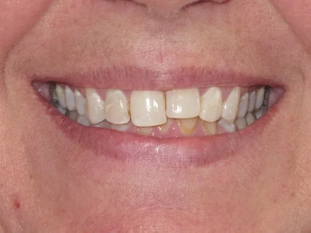 Case 2 before