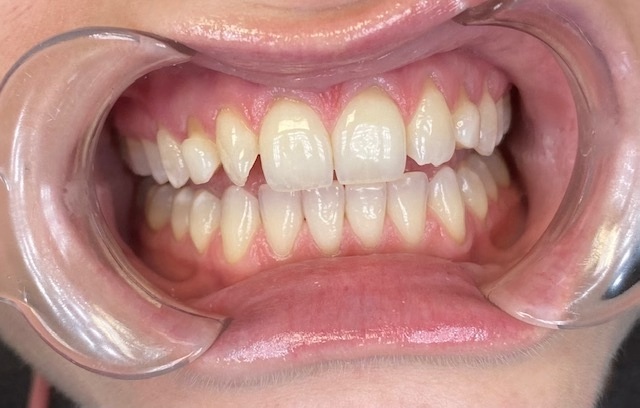 Case 8 before treatment